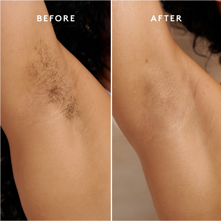 The Razor Kit customer result